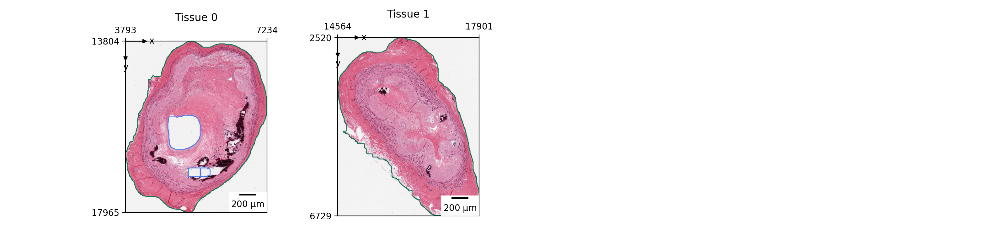 ../../_images/lazyslide-pl-tissue-1.png