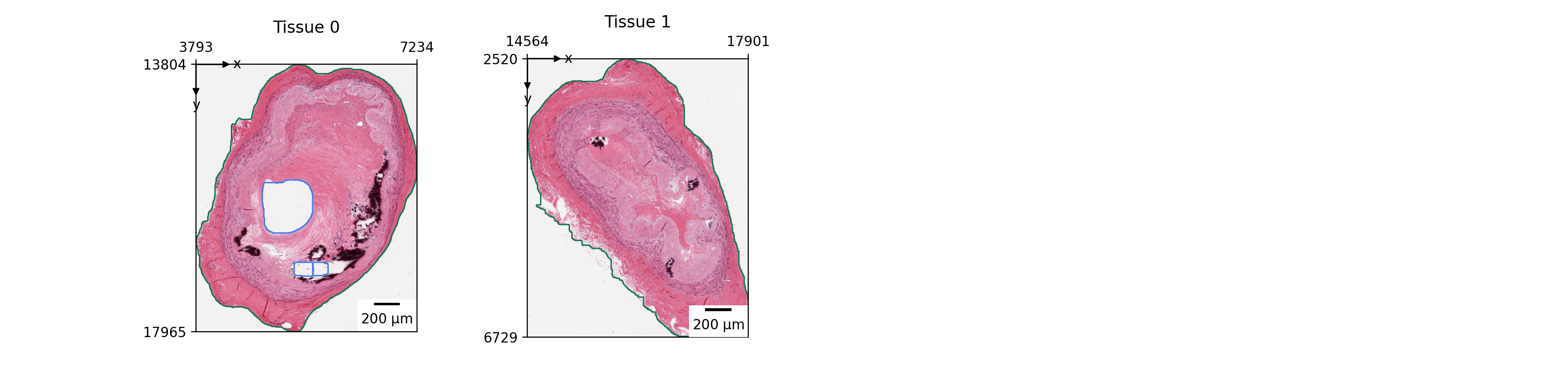 ../../_images/lazyslide-pl-tissue-1.png