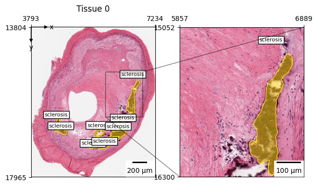 ../_images/a246522985a0265ab5eacfe056588d3269173481c6291e1a2dd9dee4d5c6f5ef.png