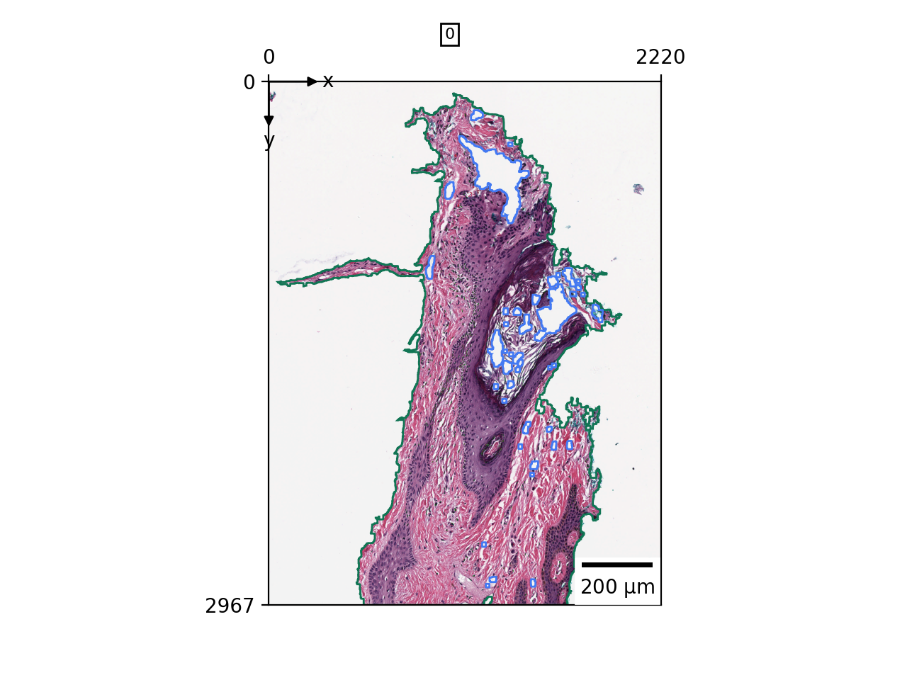 ../../_images/lazyslide-pp-find_tissues-1.png