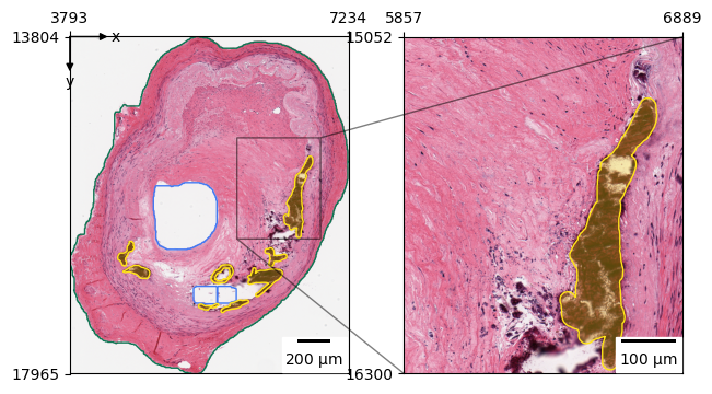 ../_images/21d2a715d40c8ccdc7929b5b861a01d1bbba0ed78cbd6568ab438f3e226bd57f.png